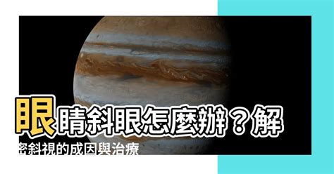 眼睛斜視|斜視：成因與治療